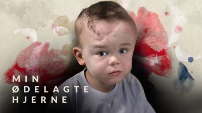 Min Ødelagte Hjerne DRTV